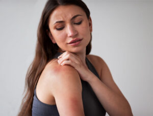 What is Atopic Dermatitis?